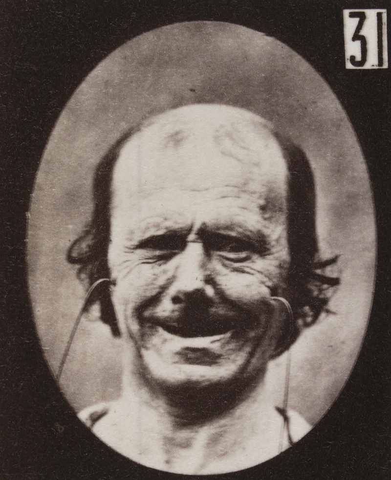 Illustration for article titled Terrifying, Century-Old Photographs from Neuroscience Experiments